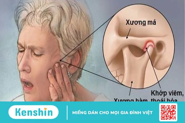 15 bệnh lý răng miệng thường gặp, nguyên nhân và cách điều trị