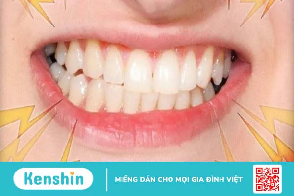 15 bệnh lý răng miệng thường gặp, nguyên nhân và cách điều trị