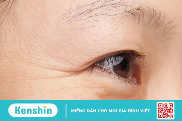 15 cách làm mặt nạ khoai tây tại nhà giúp sáng da, mờ thâm, tóc chắc khoẻ