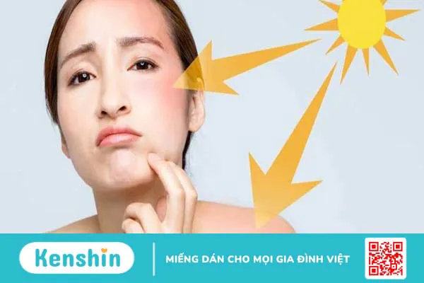 15 cách làm mặt nạ khoai tây tại nhà giúp sáng da, mờ thâm, tóc chắc khoẻ