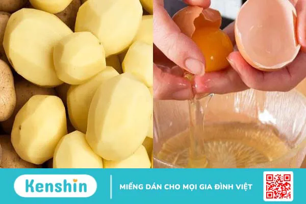 15 cách làm mặt nạ khoai tây tại nhà giúp sáng da, mờ thâm, tóc chắc khoẻ