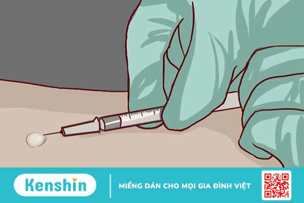 15 cách trị viêm mũi dị ứng tại nhà lành tính, hiệu quả bạn nên biết