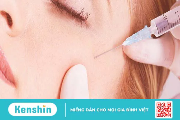 15 nguyên nhân sụp mí mắt và phương pháp khắc phục hiệu quả