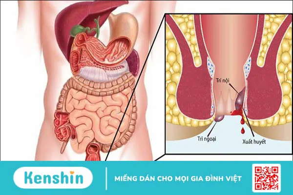 15 tác dụng của quả sung đối với sức khoẻ có thể bạn chưa biết