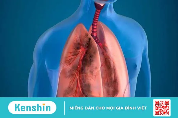 15 tác dụng của thuốc bổ não Ginkgo Biloba và những lưu ý khi sử dụng