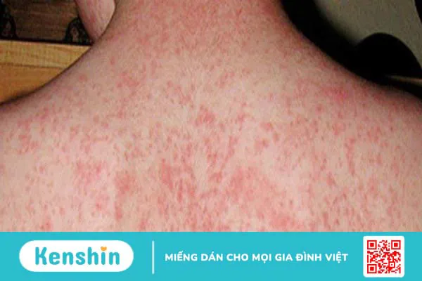 15 tác dụng của thuốc bổ não Ginkgo Biloba và những lưu ý khi sử dụng