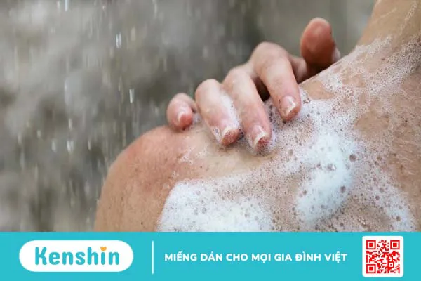 16 cách phòng ngừa và điều trị rôm sảy vào mùa nắng bạn cần biết