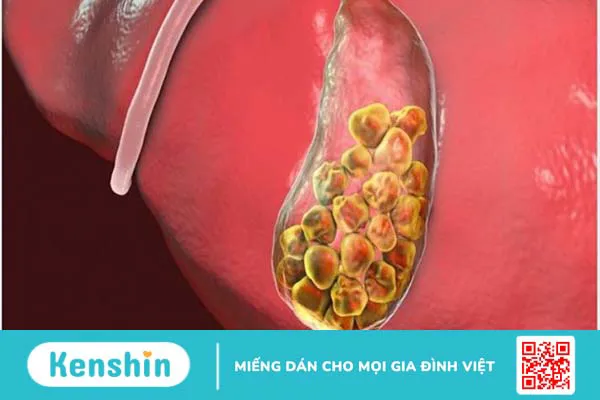 16 công dụng của đậu phộng (lạc) và các tác dụng phụ bạn nên lưu ý