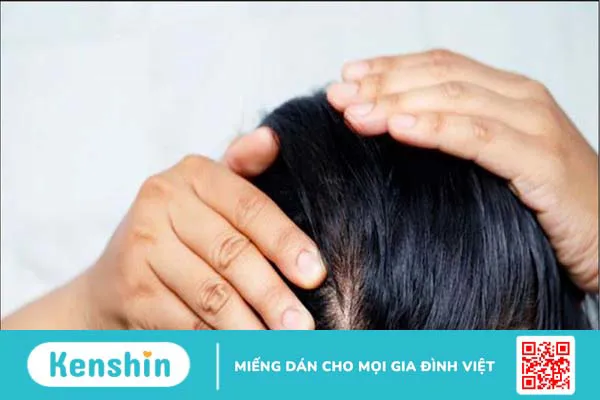 16 công dụng của đậu phộng (lạc) và các tác dụng phụ bạn nên lưu ý