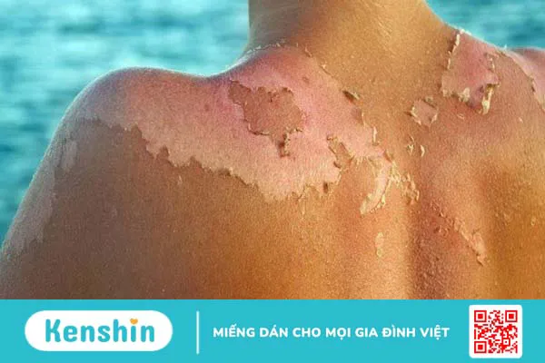 16 công dụng của trà xanh đối với sức khỏe bạn cần biết