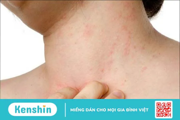 16 công dụng của vaseline trong làm đẹp và lưu ý khi sử dụng