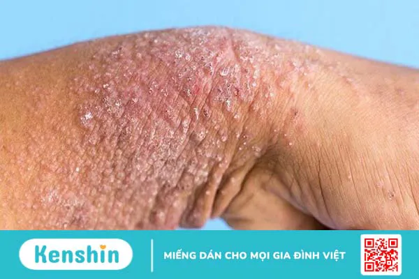 16 công dụng của vaseline trong làm đẹp và lưu ý khi sử dụng