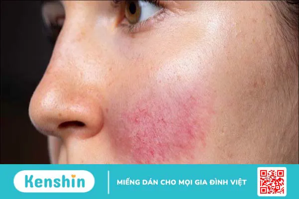 16 công dụng của vaseline trong làm đẹp và lưu ý khi sử dụng