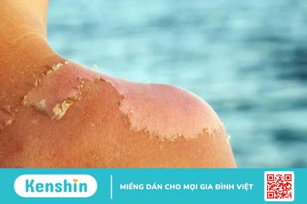 16 công dụng của vaseline trong làm đẹp và lưu ý khi sử dụng