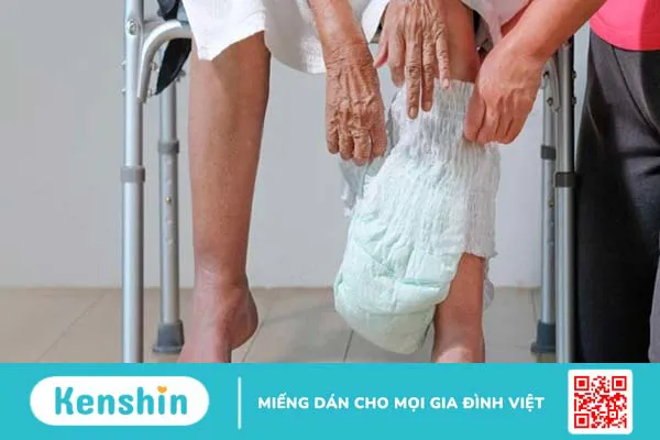 16 di chứng sau đột quỵ thường gặp và các biện pháp phòng ngừa đột quỵ