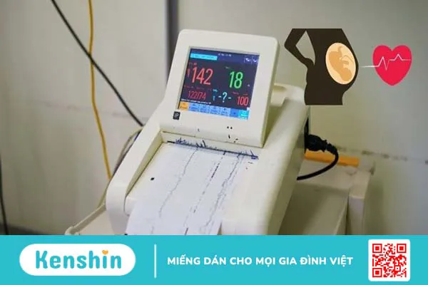 16 mẹo dân gian biết trai hay gái và những điều bố mẹ cần lưu ý