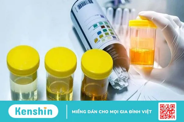 16 mẹo dân gian biết trai hay gái và những điều bố mẹ cần lưu ý