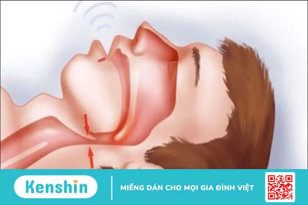 16 nguyên nhân ngủ nhiều nhưng vẫn buồn ngủ và cách phòng ngừa