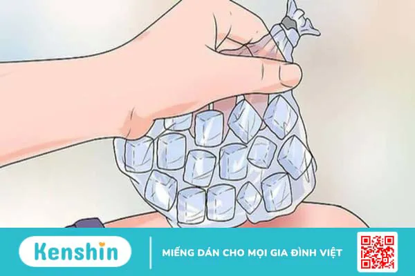 17 cách chữa viêm da cơ địa tại nhà an toàn bạn nên lưu ý ngay!