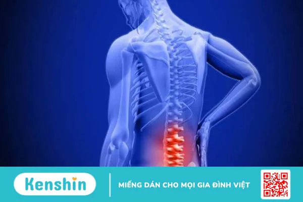 17 mẹo giảm đau lưng tại nhà hiệu quả