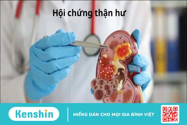 17 nguyên nhân tràn dịch màng phổi nhất định bạn cần lưu tâm