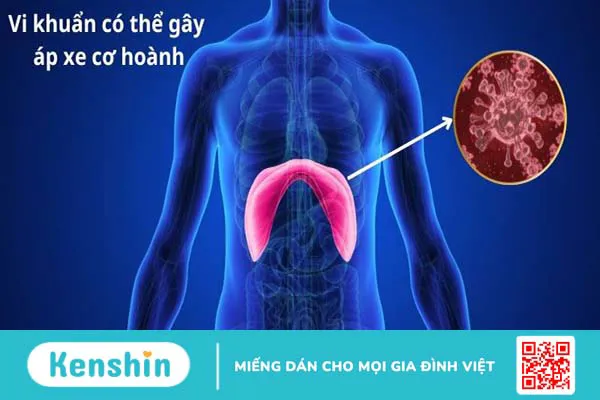 17 nguyên nhân tràn dịch màng phổi nhất định bạn cần lưu tâm