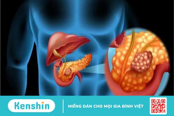 17 nguyên nhân tràn dịch màng phổi nhất định bạn cần lưu tâm