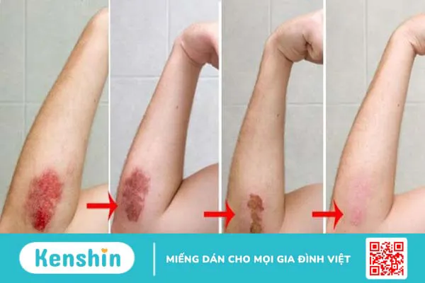 17 tác dụng của tinh dầu chanh đối với sức khỏe bạn cần biết