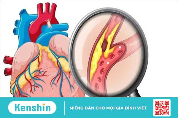 18 tác dụng của dầu cá đối với sức khỏe bạn nên biết