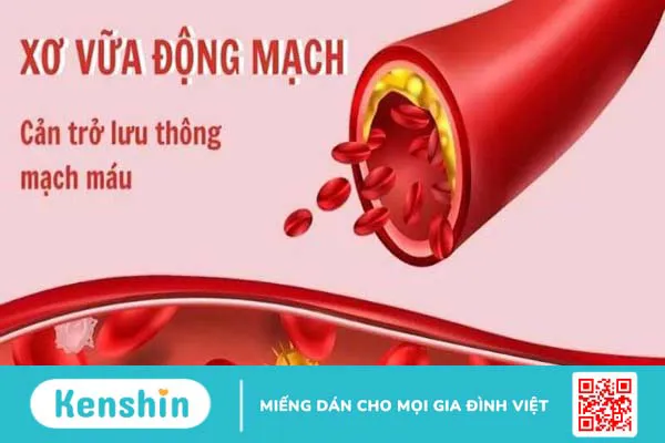 18 tác dụng của dầu cá đối với sức khỏe bạn nên biết