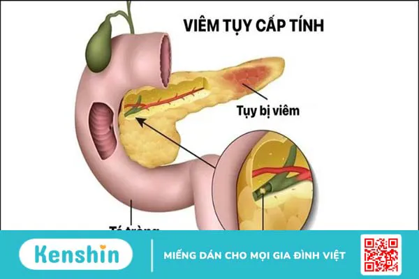 21 tác hại của rượu bia đối với sức khỏe con người mà bạn nên tránh