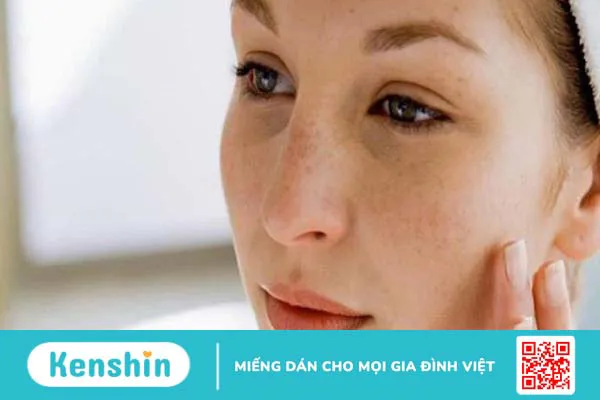 23 cách trị mụn trứng cá tại nhà an toàn, hiệu quả trong thời gian ngắn