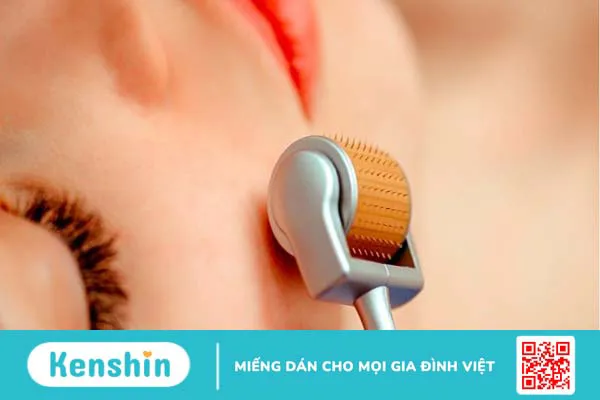 23 cách trị sẹo mụn tại nhà, an toàn đơn giản giúp da mịn màng hơn