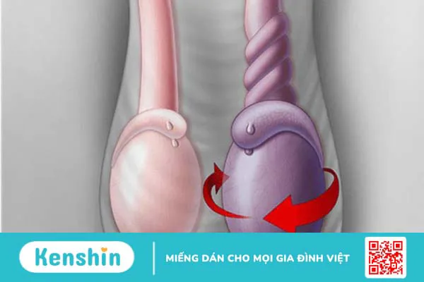 3 bệnh cực nguy hiểm chỉ xuất hiện ở nam giới mà bạn nên biết