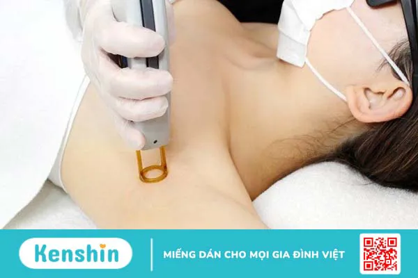 3 cách trị thâm nách tại nhà an toàn, hiệu quả dành cho các chị em