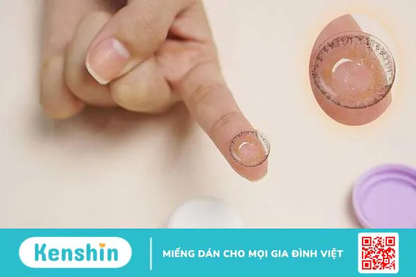 3 nguyên nhân đau mắt đỏ thường gặp và cách phòng ngừa