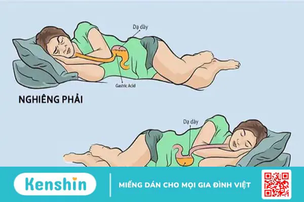 35 cách chữa trào ngược dạ dày ngày lễ đơn giản ngay tại nhà