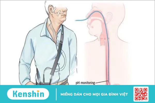 35 cách chữa trào ngược dạ dày ngày lễ đơn giản ngay tại nhà