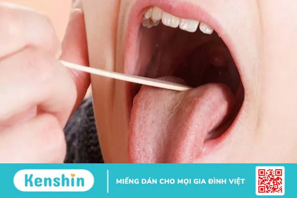 4 cách lấy sỏi amidan tại nhà giúp bạn điều trị sỏi amidan hiệu quả