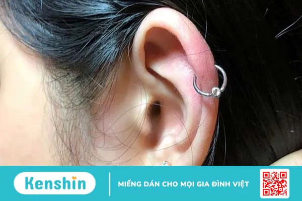 4 dấu hiệu nhiễm trùng khi bấm lỗ tai cần lưu ý kịp thời