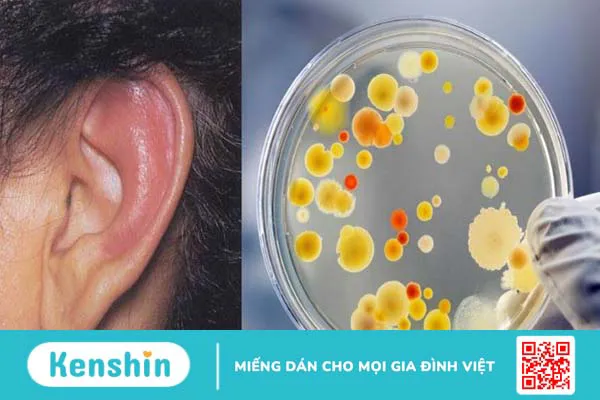 4 lưu ý tránh nhiễm trùng khi bấm lỗ tai không thể bỏ qua!