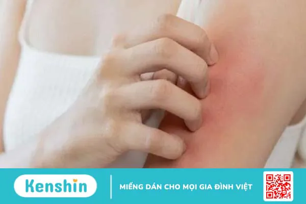 4 tác hại của nước dâu tằm khi dùng nhiều – Lưu ý ăn dâu tằm bạn cần biết