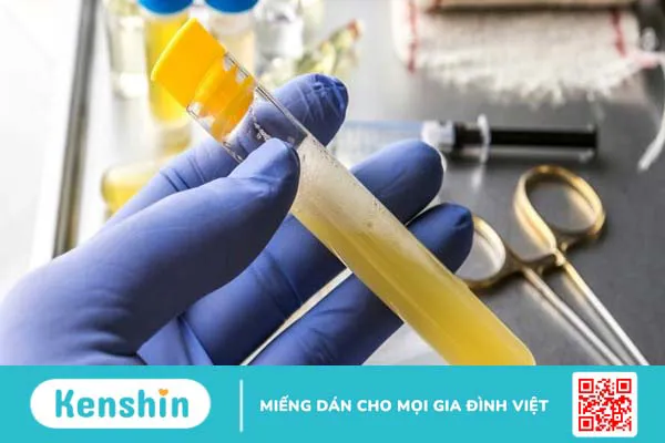 4 triệu chứng thận hư giúp bạn nhận biết bệnh chính xác