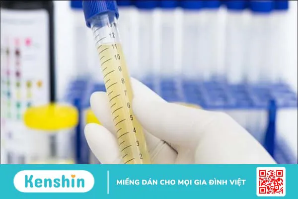 4 triệu chứng thận hư giúp bạn nhận biết bệnh chính xác