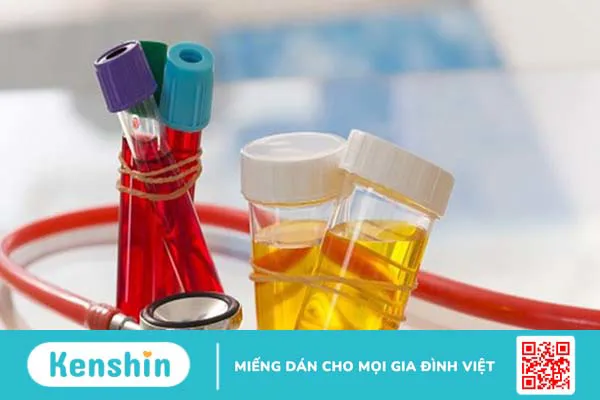 4 triệu chứng viêm đường tiết niệu giúp bạn nhận biết bệnh chính xác