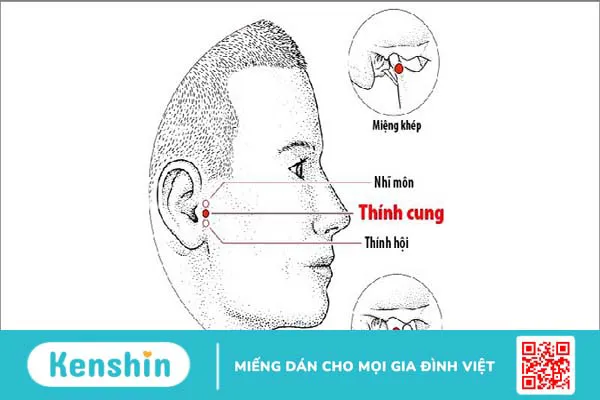 5 cách bấm huyệt chữa ù tai hiệu quả có thể bạn chưa biết