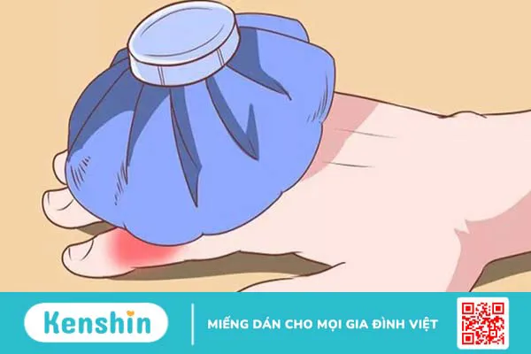 5 cách chữa viêm khớp ngón tay chuẩn khoa học bạn nên biết