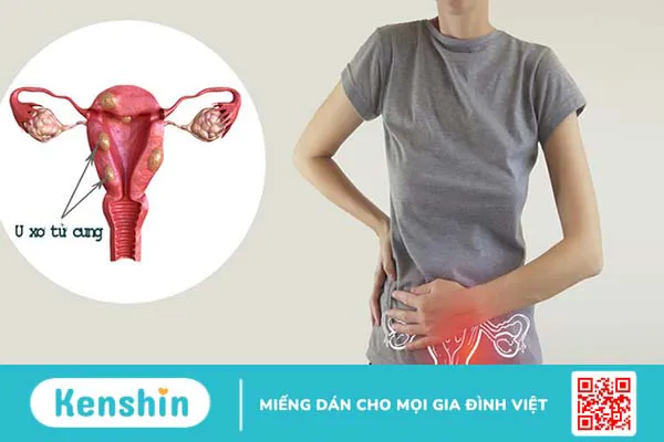 5 cách giảm đau bụng kinh tại nhà đơn giản, hiệu quả