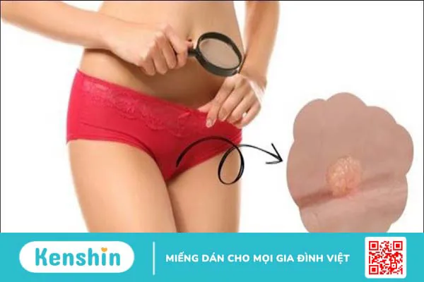 5 cách mặc quần lọt khe đúng cách, tránh gây hại cho vùng kín