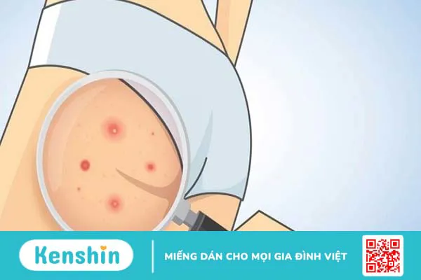 5 cách mặc quần lọt khe đúng cách, tránh gây hại cho vùng kín